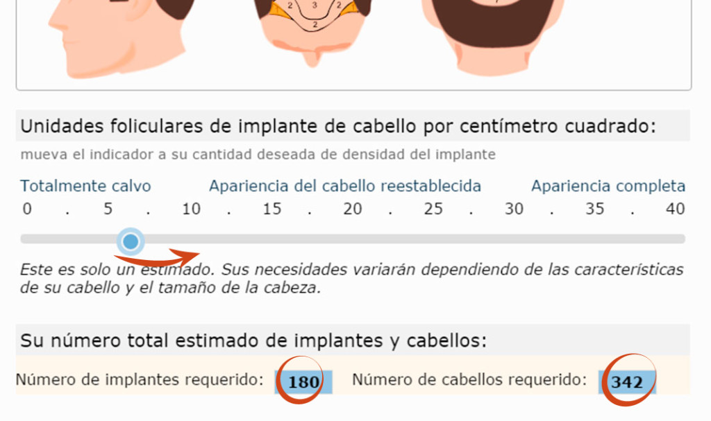 implante capilar, costo de un implante capilar, precio de un implante capilar colombia, precios implantes de pelo colombia, implante capilar bogotá